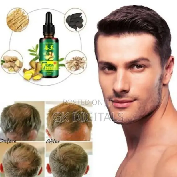 Ginger Hair Beard Serum – Thicker, Healthier Growth · Photo 1