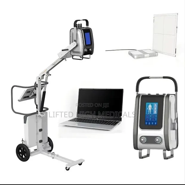 Sontu60 Portable Digital X-Ray / Xray Machine 8kw Dr System · Photo 1
