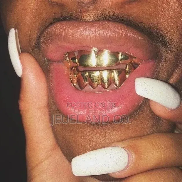Original 14k Gold Grillz / Slugs · Photo 1