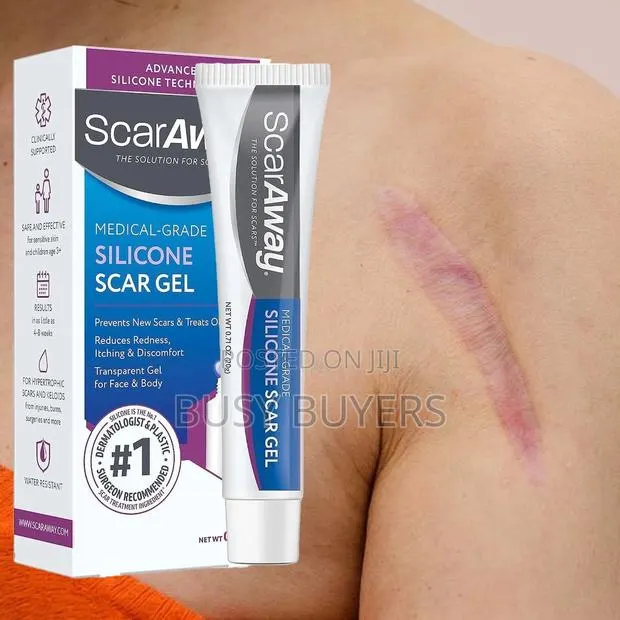 Scaraway The Solution For Scars(Medical-grade Silicone Scar Gel ) · Photo 1